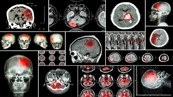 它是身体的“发动机”？4个知识深化了解！